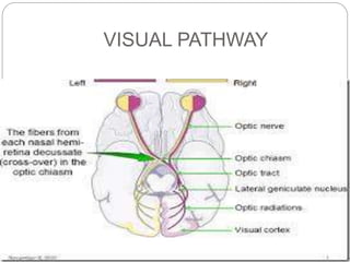 Visual Conduction Pathway Anatomy & Refraction of eye | PPTX