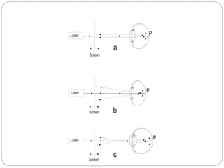 Anatomy & Refraction of eye | PPTX