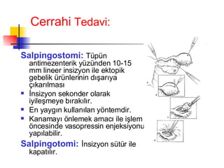 Cerrahi  Tedavi: Salpingostomi:   Tüpün antimezenterik yüzünden 10-15 mm lineer insizyon ile ektopik gebelik ürünlerinin dışarıya çıkarılması İnsizyon sekonder olarak iyileşmeye bırakılır. En yaygın kullanılan yöntemdir. Kanamayı önlemek amacı ile işlem öncesinde vasopressin enjeksiyonu yapılabilir. Salpingotomi:   İnsizyon sütür ile kapatılır.  