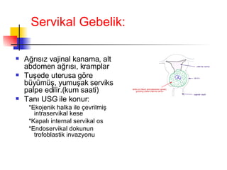 Servikal Gebelik: Ağrısız vajinal kanama, alt abdomen ağrısı, kramplar Tuşede uterusa göre büyümüş, yumuşak serviks palpe edilir.(kum saati) Tanı USG ile konur: *Ekojenik halka ile çevrilmiş intraservikal kese *Kapalı internal servikal os *Endoservikal dokunun trofoblastik invazyonu 