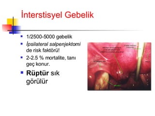 İnterstisyel Gebelik 1/2500-5000 gebelik İpsilateral salpenjektomi  de risk faktörü! 2-2.5 % mortalite, tanı geç konur. Rüptür  sık  görülür 