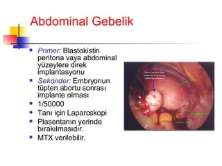 Abdominal Gebelik Primer:  Blastokistin peritona vaya abdominal yüzeylere direk implantasyonu Sekonder:  Embryonun tüpten abortu sonrası implante olması 1/50000 Tanı için Laparoskopi P lasentanın yerinde bırakılmasıdır.  MTX verilebilir. 