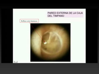 Reflejo corio-luminoso