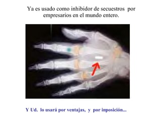 Y Ud.  lo usará por ventajas,  y  por imposición...   Ya es usado como inhibidor de secuestros  por empresarios en el mundo entero. 