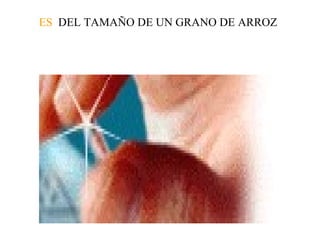 ES   DEL TAMAÑO DE UN GRANO DE ARROZ 