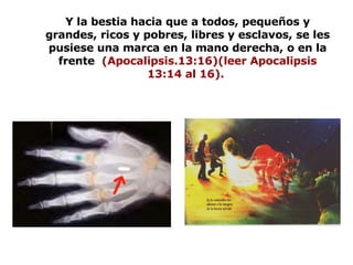 Y la bestia hacia que a todos, pequeños y grandes, ricos y pobres, libres y esclavos, se les pusiese una marca en la mano derecha, o en la frente  (Apocalipsis.13:16)(leer Apocalipsis 13:14 al 16).   