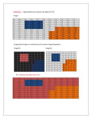 EXERCICE 3 : segmentation par croissance de régions (L P E)
Image I
3 6 5 6 4 6 5 3 4 2 1
6 4 101 100 103 5 3 4 3 2 1
4 3 102 102 102 4 2 3 2 1 3
5 5 99 101 103 4 4 3 4 5 5
4 6 103 104 105 3 4 216 213 210 209
5 3 4 6 5 3 7 214 212 214 100
1 4 2 0 0 5 216 209 211 209 102
0 2 3 2 3 6 212 211 210 213 99
2 4 3 1 3 4 216 206 215 214 99
1 1 2 1 2 6 207 206 213 214 102
1)-segmenter limage I en utilisant G2 et G1 comme image de gradient
Image G2 Image G1
 Croissance de régions pour G1 :
1 1 1 1 1 1 1 1 1 1 1
1 1 2 2 2 1 1 1 1 1 1
1 1 2 2 2 1 1 1 1 1 1
1 1 2 2 2 1 1 1 1 1 1
1 1 1 1 1 1 1 3 3 3 3
1 1 1 1 1 1 1 3 3 3 3
1 1 1 1 1 1 3 3 3 3 3
1 1 1 1 1 1 3 3 3 3 3
1 1 1 1 1 1 3 3 3 3 3
1 1 1 1 1 1 3 3 3 3 3
 