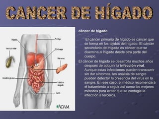 cáncer de hígado      El cáncer primario de hígado es cáncer que se forma en los tejidos del hígado. El cáncer secundario del hígado es cáncer que se disemina al hígado desde otra parte del cuerpo. El cáncer de hígado se desarrolla muchos años después de adquirir la  infección viral . Aunque estas infecciones pueden transcurrir sin dar síntomas, los análisis de sangre pueden detectar la presencia del virus en la sangre. En ese caso, el médico recomendará el tratamiento a seguir así como los mejores métodos para evitar que se contagie la infección a terceros. CANCER DE HÍGADO 