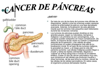   ¿QUÉ ES? Se trata de uno de los tipos de tumores más difíciles de diagnosticar, debido a que los síntomas suelen aparecer cuando la enfermedad ya está en una fase demasiado avanzada. Además, la localización de esta glándula impide que los tumores más pequeños sean detectados durante las revisiones rutinarias.  Los tumores de páncreas pueden dividirse en dos grandes grupos, según su naturaleza, benignos o malignos. Los primeros no son cancerígenos, y los cirujanos pueden extirparlos sin mayor complicación. De hecho, la mayoría de las veces no vuelven a reaparecer después de la operación, y las células de estas tumoraciones no suelen propagarse más allá de su localización inicial. En el caso de los tumores malignos, la gravedad es mayor, y el riesgo para la vida del paciente aumenta. Las células malignas pueden llegar a invadir y dañar los tejidos colindantes, llegando a 'colarse' en el flujo sanguíneo e incluso en el sistema linfático. Existe un tipo de cáncer pancreático muy raro, que comienza en las células que producen insulina y otras hormonas, de las que toma su nombre, cáncer de las células de los islotes pancreáticos. En estos casos, el organismo produce demasiada insulina. CANCER DE PÁNCREAS 
