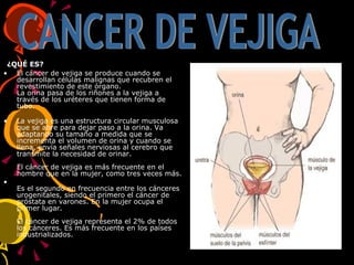   ¿QUÉ ES? El cáncer de vejiga se produce cuando se desarrollan células malignas que recubren el revestimiento de este órgano. La orina pasa de los riñones a la vejiga a través de los uréteres que tienen forma de tubo. La vejiga es una estructura circular musculosa que se abre para dejar paso a la orina. Va adaptando su tamaño a medida que se incrementa el volumen de orina y cuando se llena, envía señales nerviosas al cerebro que transmite la necesidad de orinar. El cáncer de vejiga es más frecuente en el hombre que en la mujer, como tres veces más. Es el segundo en frecuencia entre los cánceres urogenitales, siendo el primero el cáncer de próstata en varones. En la mujer ocupa el primer lugar. El cáncer de vejiga representa el 2% de todos los cánceres. Es más frecuente en los países industrializados. CANCER DE VEJIGA 