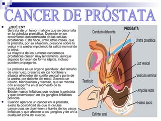   ¿QUÉ ES? Se trata de un tumor maligno que se desarrolla en la glándula prostática. Consiste en un crecimiento descontrolado de las células prostáticas. Esto hace, entre otras cosas, que la próstata, por su situación, presione sobre la vejiga y la uretra impidiendo la salida normal de la orina. La mayoría de los tumores cancerosos prostáticos crecen muy lentamente, aunque algunos lo hacen de forma rápida, incluso pueden propagarse. La próstata es un órgano glandular, del tamaño de una nuez, presente en los hombres y situada alrededor del cuello vesical y parte de la uretra, por delante del recto. Secreta un líquido, blanquecino y viscoso, que se mezcla con el esperma en el momento de la eyaculación. Existen vasos linfáticos que rodean la próstata y que desembocan en los ganglios linfáticos pélvicos. Cuando aparece un cáncer en la próstata, existe la posibilidad de que la células cancerosas se diseminen a través de los vasos linfáticos y que afecten a los ganglios y de ahí a cualquier zona del cuerpo. CANCER DE PRÓSTATA 