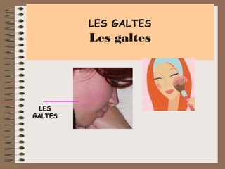LES GALTES

Les galtes

LES
GALTES

 
