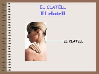 EL CLATELL

El clatell

EL CLATELL

 