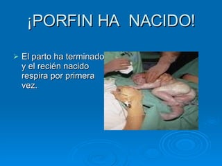 ¡PORFIN HA NACIDO! El parto ha terminado y el recién nacido respira por primera vez.