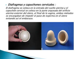  Diafragmas y capuchones cervicales :
El diafragma se coloca en la entrada del cuello uterino y el
capuchón cervical se coloca en la parte arqueada del orificio
uterino exterior del útero, al final de la vagina, ambos métodos
se encargaban de impedir el paso de esperma en el útero
evitando así el embarazo.
 