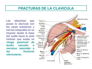 FRACTURAS DE LA CLAVICULA Las relaciones que posee la clavícula con los vasos subclavios y nervios braquiales en su trayecto desde la base del cuello hacia la axila motivan que exista un  riesgo potencial de lesión vascular o nerviosa asociado a las fracturas claviculares. 