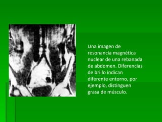 Una imagen de resonancia magnética nuclear de una rebanada de abdomen. Diferencias de brillo indican diferente entorno, por ejemplo, distinguen grasa de músculo.  