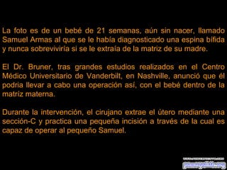 La foto es de un bebé de 21 semanas, aún sin nacer, llamado Samuel Armas al que se le había diagnosticado una espina bífida y nunca sobreviviría si se le extraía de la matriz de su madre. El Dr. Bruner, tras grandes estudios realizados en el Centro Médico Universitario de Vanderbilt, en Nashville, anunció que él podria llevar a cabo una operación así, con el bebé dentro de la matríz materna. Durante la intervención, el cirujano extrae el útero mediante una sección-C y practica una pequeña incisión a través de la cual es capaz de operar al pequeño Samuel. 