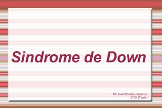 Sindrome de Down Mª José Morales Barranco 2º EI (Tarde) 