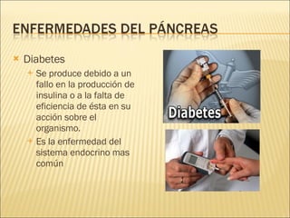 Diabetes Se produce debido a un fallo en la producción de insulina o a la falta de eficiencia de ésta en su acción sobre el organismo. Es la enfermedad del sistema endocrino mas común 