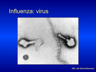 Influenza: virus ©Dr. Jair García-Guerrero