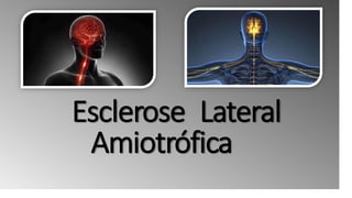 Esclerose Lateral
Amiotrófica
 