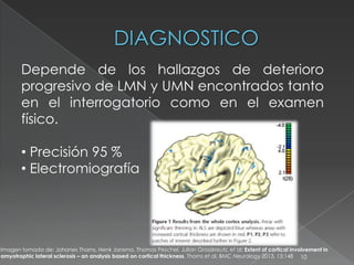 10
Depende de los hallazgos de deterioro
progresivo de LMN y UMN encontrados tanto
en el interrogatorio como en el examen
físico.
• Precisión 95 %
• Electromiografía
Imagen tomada de: Johanes Thorns, Henk Jansma, Thomas Peschel, Julian Grosskreutz, et al: Extent of cortical involvement in
amyotrophic lateral sclerosis – an analysis based on cortical thickness. Thorns et al. BMC Neurology 2013, 13:148
 