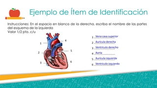 Ejemplo de Ítem de Identificación
Instrucciones: En el espacio en blanco de la derecha, escriba el nombre de las partes
del esquema de la izquierda
Valor 1/2 pto. c/u
1
2
3
4
5
6
1 ………………………….
2 ………………………….
3 ………………………….
4 ………………………….
5 ………………………….
6 ………………………….
Vena cava superior
Aurícula derecha
Ventrículo derecho
Aorta
Aurícula izquierda
Ventrículo izquierdo
 