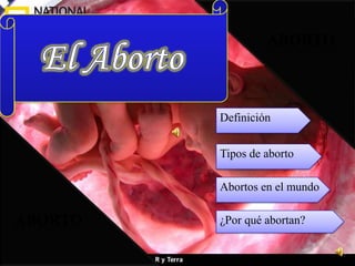 aborto El Aborto Definición Tipos de aborto Abortos en el mundo aborto ¿Por qué abortan? 