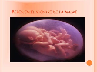 Bebes en el vientre de la madre