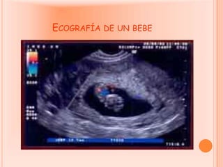 Ecografía de un bebe