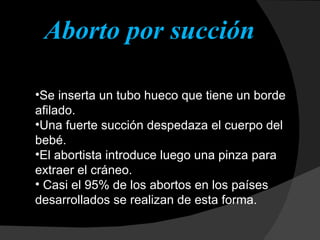 Aborto por succión Se inserta un tubo hueco que tiene un borde afilado. Una fuerte succión despedaza el cuerpo del bebé. El abortista introduce luego una pinza para extraer el cráneo. Casi el 95% de los abortos en los países desarrollados se realizan de esta forma.  