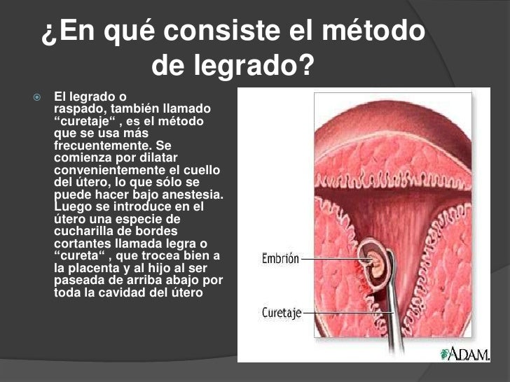 Que es legrado uterino pdf