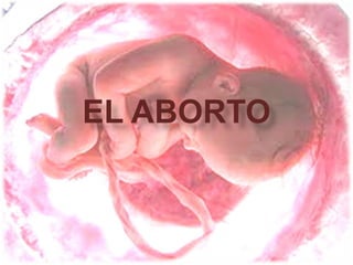 EL ABORTO
 