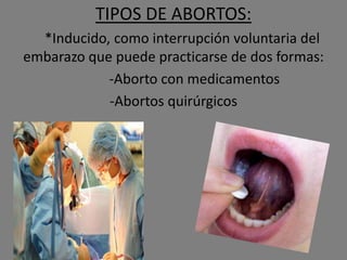 TIPOS DE ABORTOS:
  *Inducido, como interrupción voluntaria del
embarazo que puede practicarse de dos formas:
            -Aborto con medicamentos
            -Abortos quirúrgicos
 