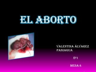 El aborto

     Valentina Álvarez
     Paniagua

             8º1

            MESA:4
 