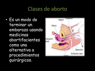 Clases de aborto
• Es un modo de
  terminar un
  embarazo usando
  medicinas
  abortifacientes
  como una
  alternativa a
  procedimientos
  quirúrgicos.
 