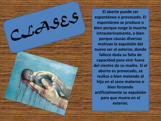 El aborto puede ser
espontáneo o provocado. El
  espontáneo se produce o
bien porque surge la muerte
 intrauterinamente, o bien
   porque causas diversas
  motivan la expulsión del
nuevo ser al exterior, donde
   fallece dada su falta de
 capacidad para vivir fuera
del vientre de su madre. Si el
   aborto es provocado, se
  realiza o bien matando al
 hijo en el seno materno o
        bien forzando
artificialmente su expulsión
    para que muera en el
           exterior.
 