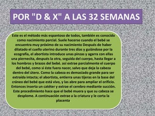 POR "D & X" A LAS 32 SEMANAS
Este es el método más espantoso de todos, también es conocido
    como nacimiento parcial. Suele hacerse cuando el bebé se
   encuentra muy próximo de su nacimiento Después de haber
  dilatado el cuello uterino durante tres días y guiándose por la
  ecografía, el abortista introduce unas pinzas y agarra con ellas
una piernecita, después la otra, seguida del cuerpo, hasta llegar a
los hombros y brazos del bebé. así extrae parcialmente el cuerpo
   del bebé, como si éste fuera nacer, salvo que deja la cabeza
 dentro del útero. Como la cabeza es demasiado grande para ser
 extraída intacta; el abortista, entierra unas tijeras en la base del
cráneo del bebé que está vivo, y las abre para ampliar el orificio.
Entonces inserta un catéter y extrae el cerebro mediante succión.
 Este procedimiento hace que el bebé muera y que su cabeza se
    desplome. A continuación extrae a la criatura y le corta la
                              placenta.
 