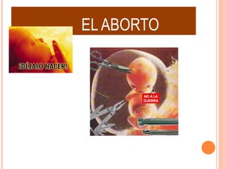 EL ABORTO 