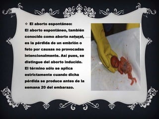  El aborto espontáneo:
El aborto espontáneo, también
conocido como aborto natural,
es la pérdida de un embrión o
feto por causas no provocadas
intencionalmente. Así pues, se
distingue del aborto inducido.
El término sólo se aplica
estrictamente cuando dicha
pérdida se produce antes de la
semana 20 del embarazo.
 