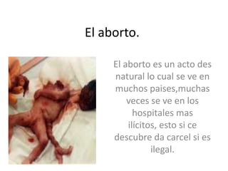 El aborto.

     El aborto es un acto des
     natural lo cual se ve en
     muchos paises,muchas
         veces se ve en los
           hospitales mas
         ilícitos, esto si ce
     descubre da carcel si es
                ilegal.
 