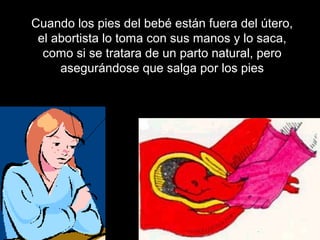 Cuando los pies del bebé están fuera del útero,
 el abortista lo toma con sus manos y lo saca,
  como si se tratara de un parto natural, pero
     asegurándose que salga por los pies
 
