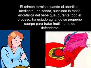 El crimen termina cuando el abortista,
 mediante una sonda, succiona la masa
encefálica del bebé que, durante todo el
proceso, ha estado agitando su pequeño
    cuerpo para tratar inútilmente de
               defenderse
 