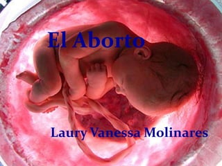 El Aborto



Laury Vanessa Molinares
 