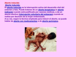 Aborto inducido
 Aborto inducido.
El aborto inducido es la interrupción activa del desarrollo vital del
embrión o feto. Puede tratarse de un aborto terapéutico (o aborto
indirecto) cuando está justificado por razones médicas, o de un
aborto electivo (interrupción voluntaria del embarazo) cuando se
realiza por decisión de la mujer embarazada.
A su vez, según la técnica empleada para inducir el aborto, se puede
hablar de aborto con medicamentos o de aborto quirúrgico.
 