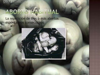 La repetición de tres o más abortos
espontáneos consecutivos
 