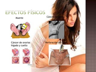 Muerte Cáncer de mama
Cáncer de ovarios
hígado y cuello
Perforación de útero
 