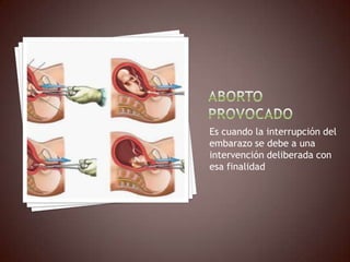 Es cuando la interrupción del
embarazo se debe a una
intervención deliberada con
esa finalidad
 