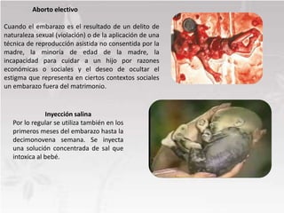 Aborto electivo
Cuando el embarazo es el resultado de un delito de
naturaleza sexual (violación) o de la aplicación de una
técnica de reproducción asistida no consentida por la
madre, la minoría de edad de la madre, la
incapacidad para cuidar a un hijo por razones
económicas o sociales y el deseo de ocultar el
estigma que representa en ciertos contextos sociales
un embarazo fuera del matrimonio.
Inyección salina
Por lo regular se utiliza también en los
primeros meses del embarazo hasta la
decimonovena semana. Se inyecta
una solución concentrada de sal que
intoxica al bebé.
 